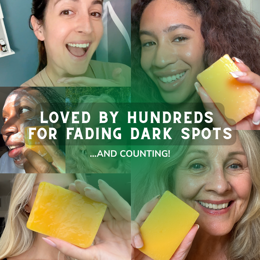 The Superfood Soap For DARK SPOTS