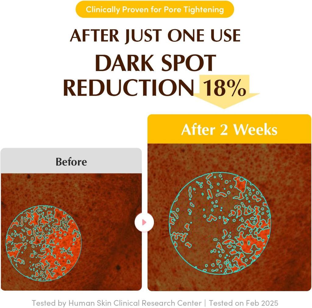 RADIANCE GLOW Face Mask