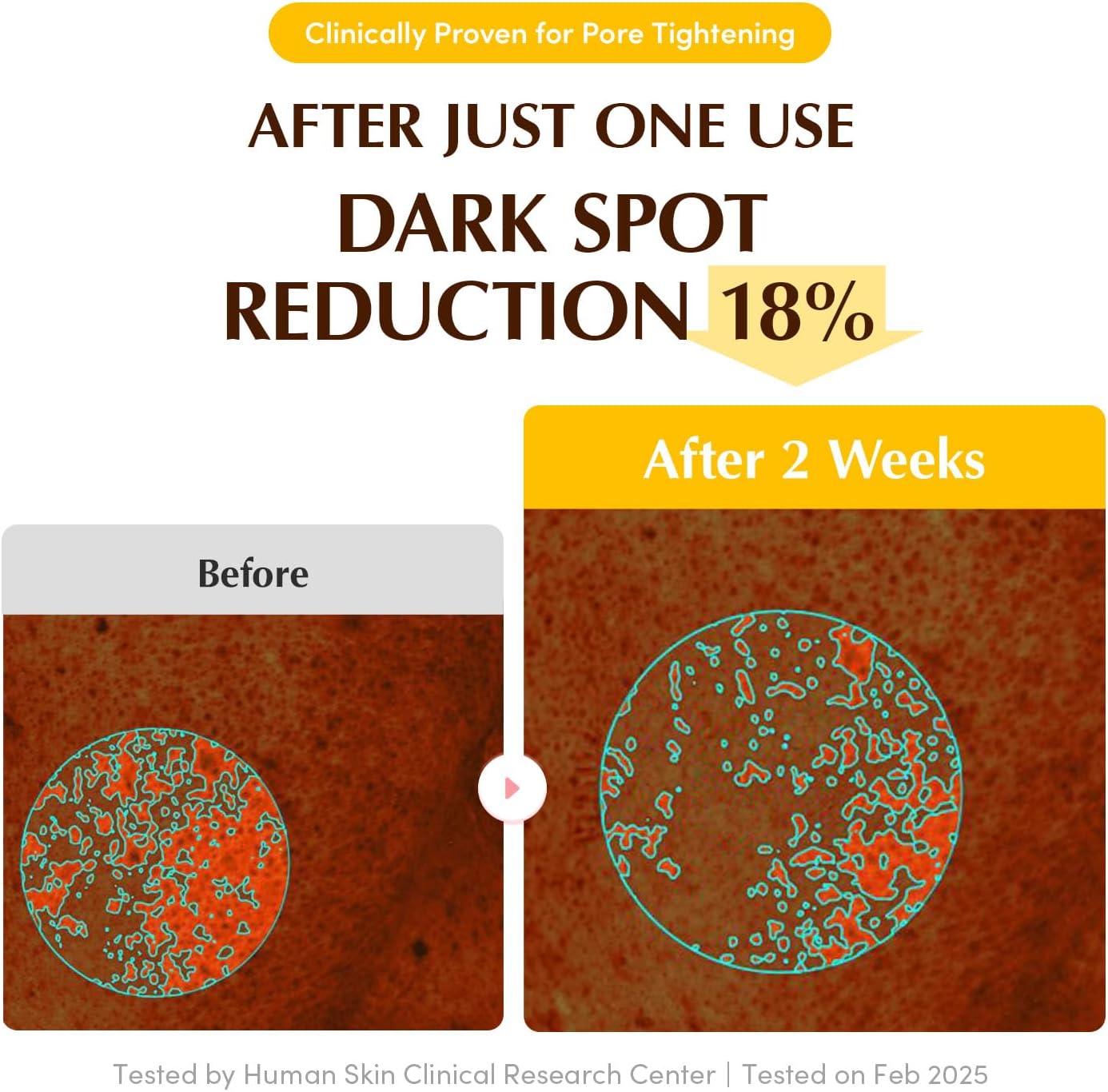 RADIANCE GLOW Face Mask