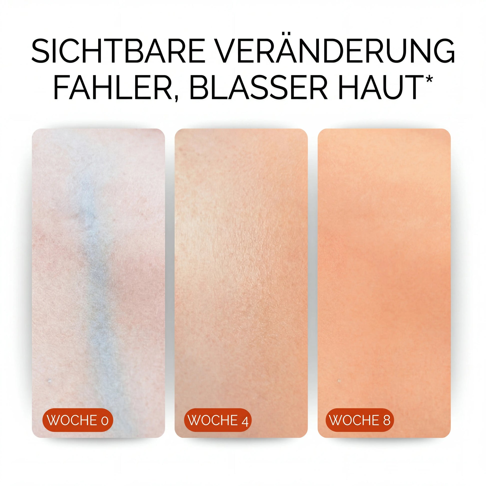 SUN – Strahlkraft-Formel