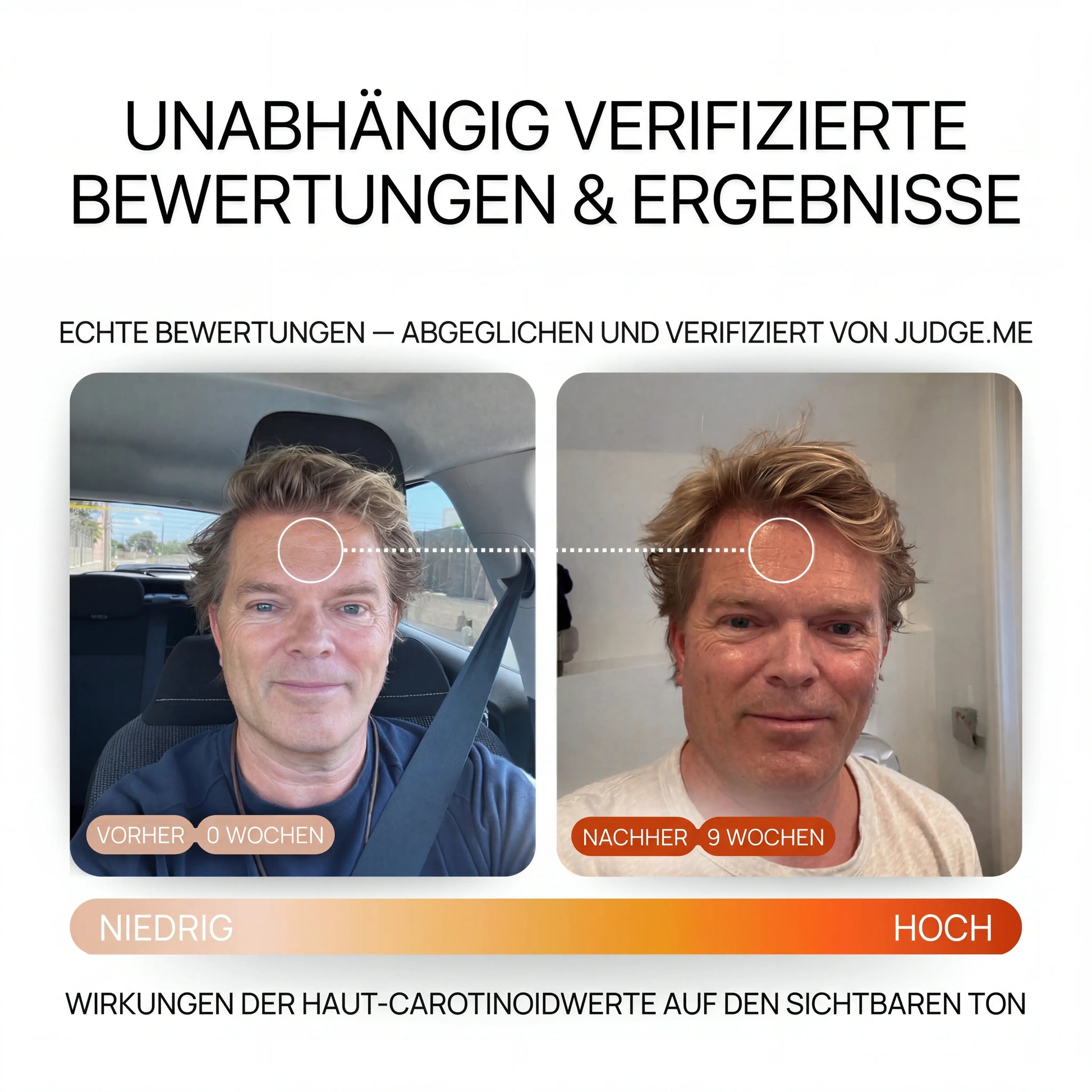 SUN – Strahlkraft-Formel