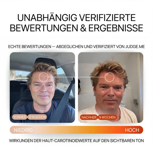 SUN – Strahlkraft-Formel